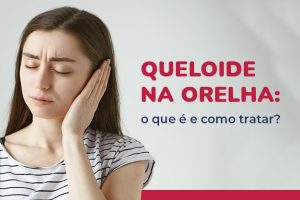 Queloide na Orelha