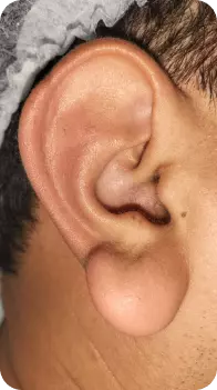 orelha grande, antes de realizar a macrotia