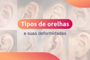 vários tipos de orelhas e suas deformidade com letreiro por cima escrito "Tipos de orelhas e suas deformidades"