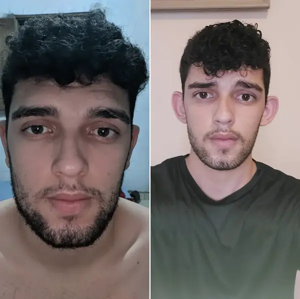 Dr. Andre Ricardo Otoplastia