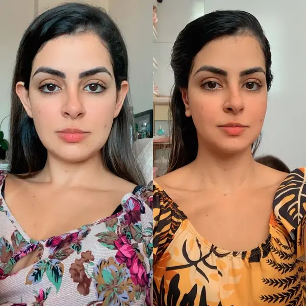 Dr. Andre Ricardo Otoplastia