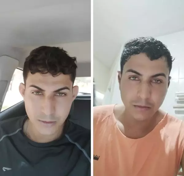 Dr. Andre Ricardo Otoplastia