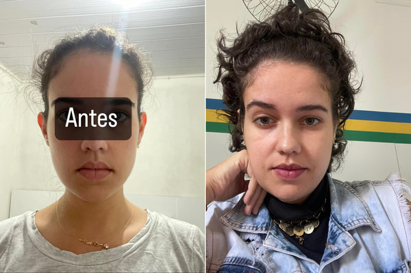 Dr. Andre Ricardo Otoplastia