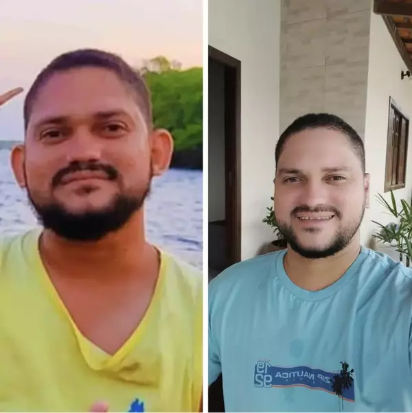 Dr. Andre Ricardo Otoplastia