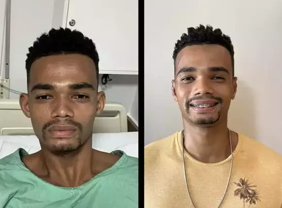 Dr. Andre Ricardo Otoplastia