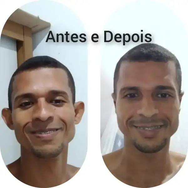 Dr. Andre Ricardo Otoplastia