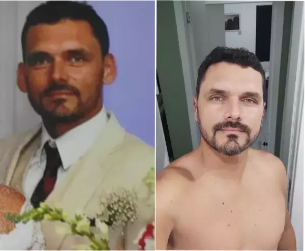 Dr. Andre Ricardo Otoplastia