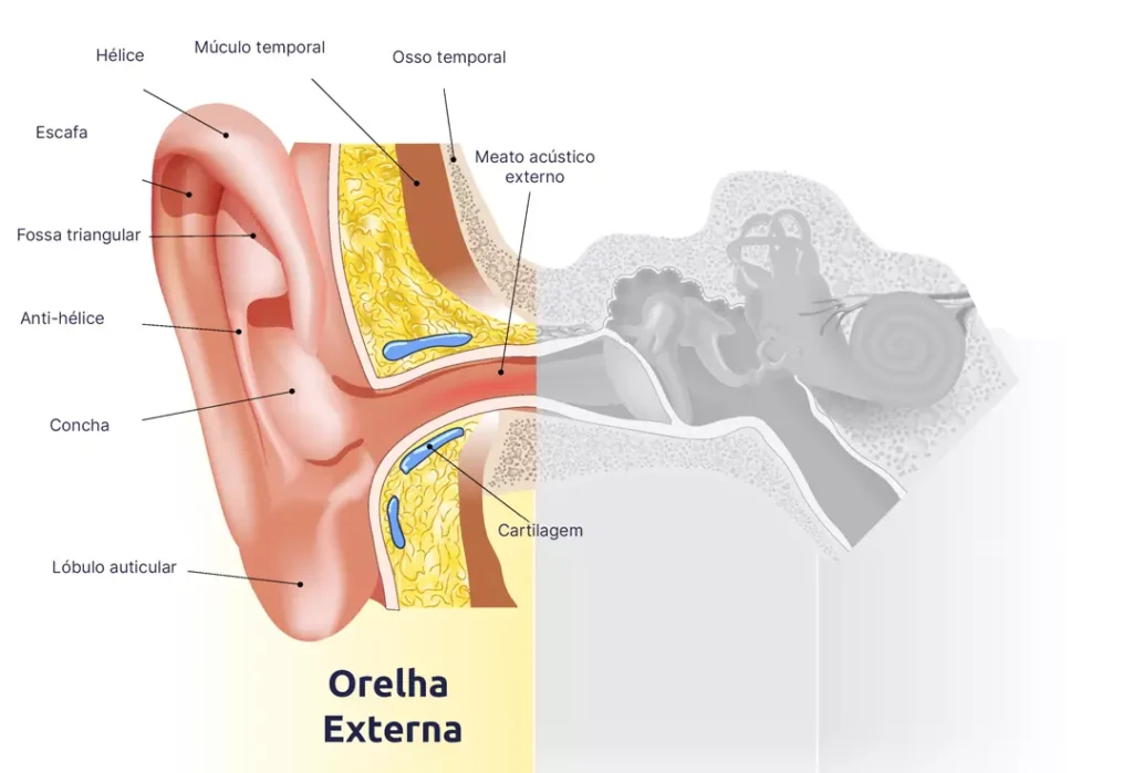malformação da orelha externa