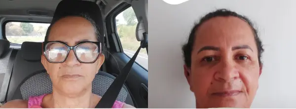 Dr. Andre Ricardo Otoplastia