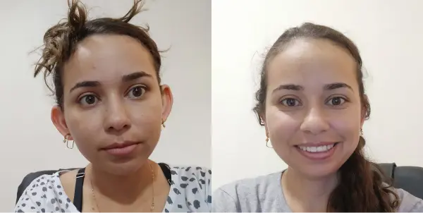 Dr. Andre Ricardo Otoplastia