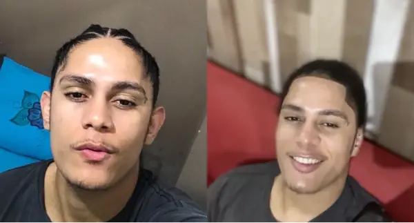 Dr. Andre Ricardo Otoplastia