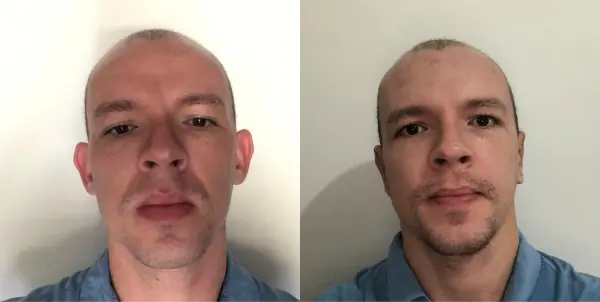 Dr. Andre Ricardo Otoplastia