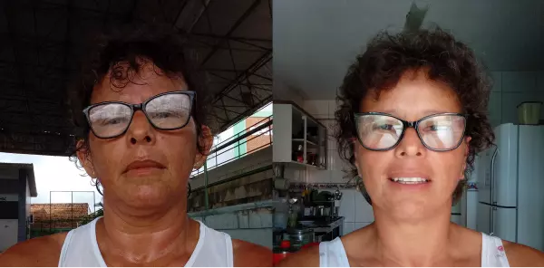 Dr. Andre Ricardo Otoplastia