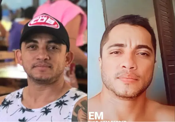 Antes e depois da otoplastia Dr. Lucas Macedo