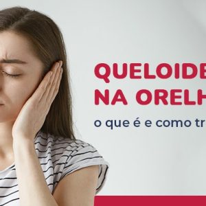 Queloide na Orelha