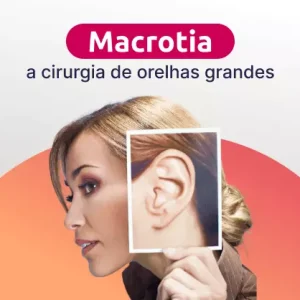 Cirurgia de Orelhas Grandes