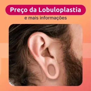 preco-da-lobuloplastia-e-mais-informacoes lobuloplastia preço