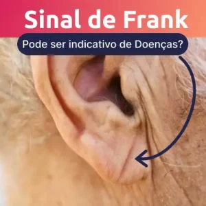 sinal de Frank