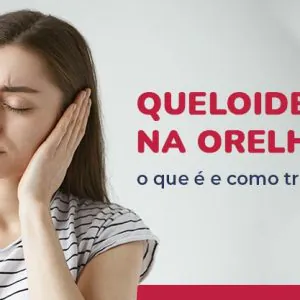 Queloide na Orelha